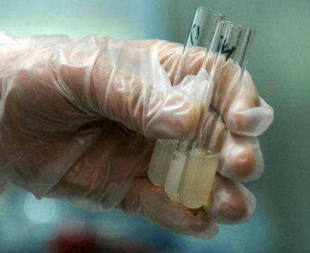 检查 (11) 检查 (11)